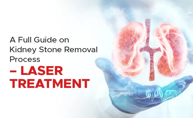 Kidney Stone Laser Surgery Ludhiana